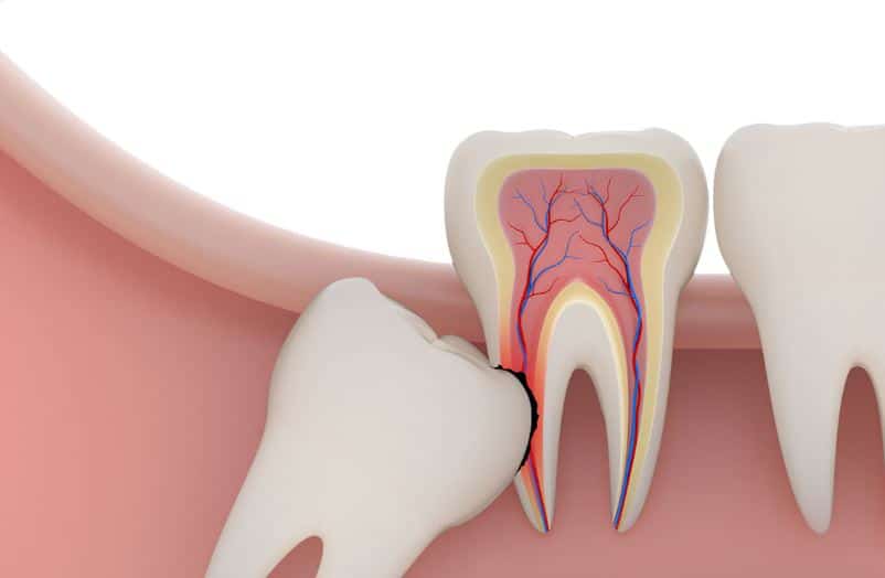 Nằm mơ thấy nhổ răng điềm gì, nằm mơ thấy nhổ răng đánh số gì dễ trúng